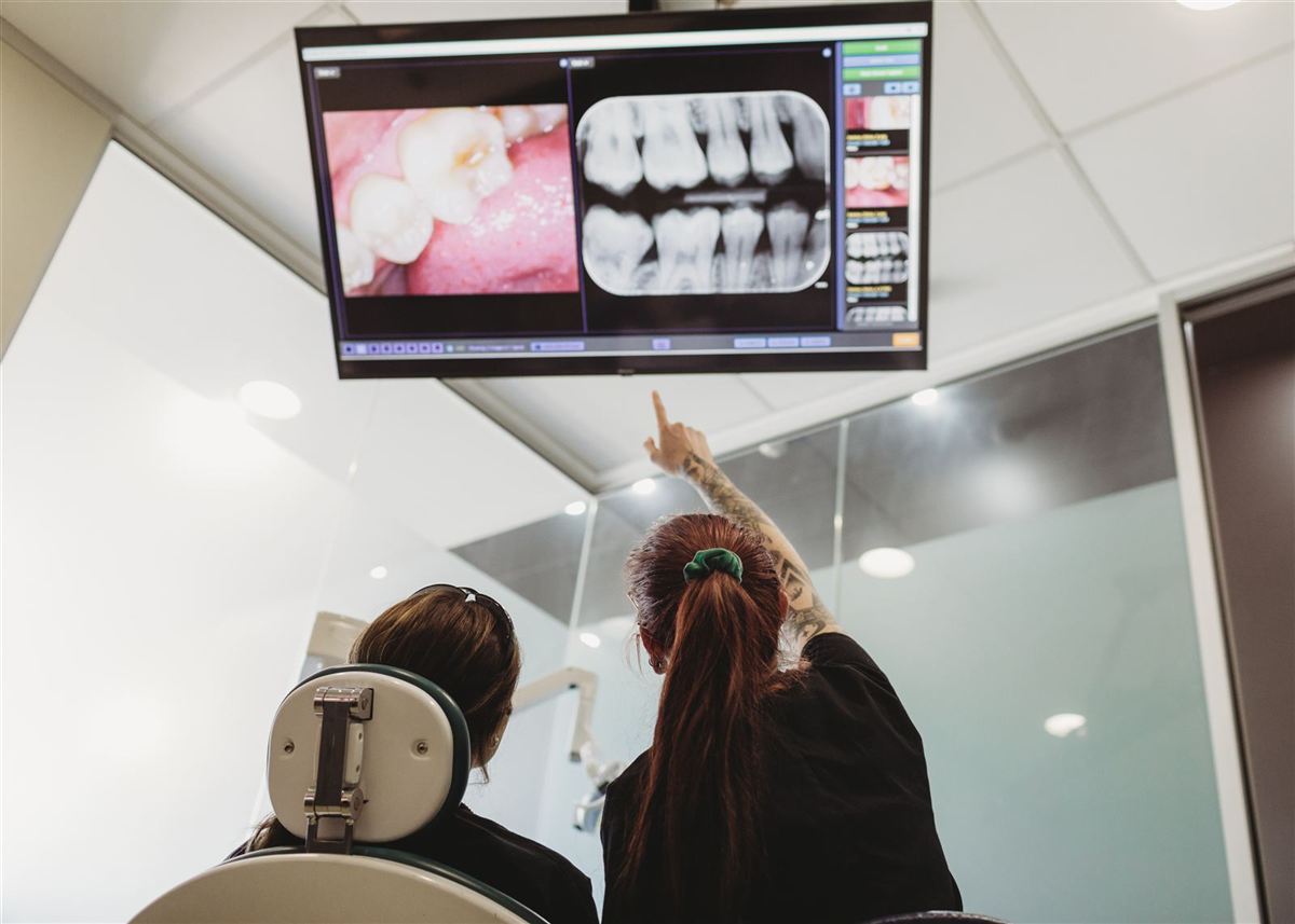 Southside Dental team members reviewing dental X-rays together on a large wall screen